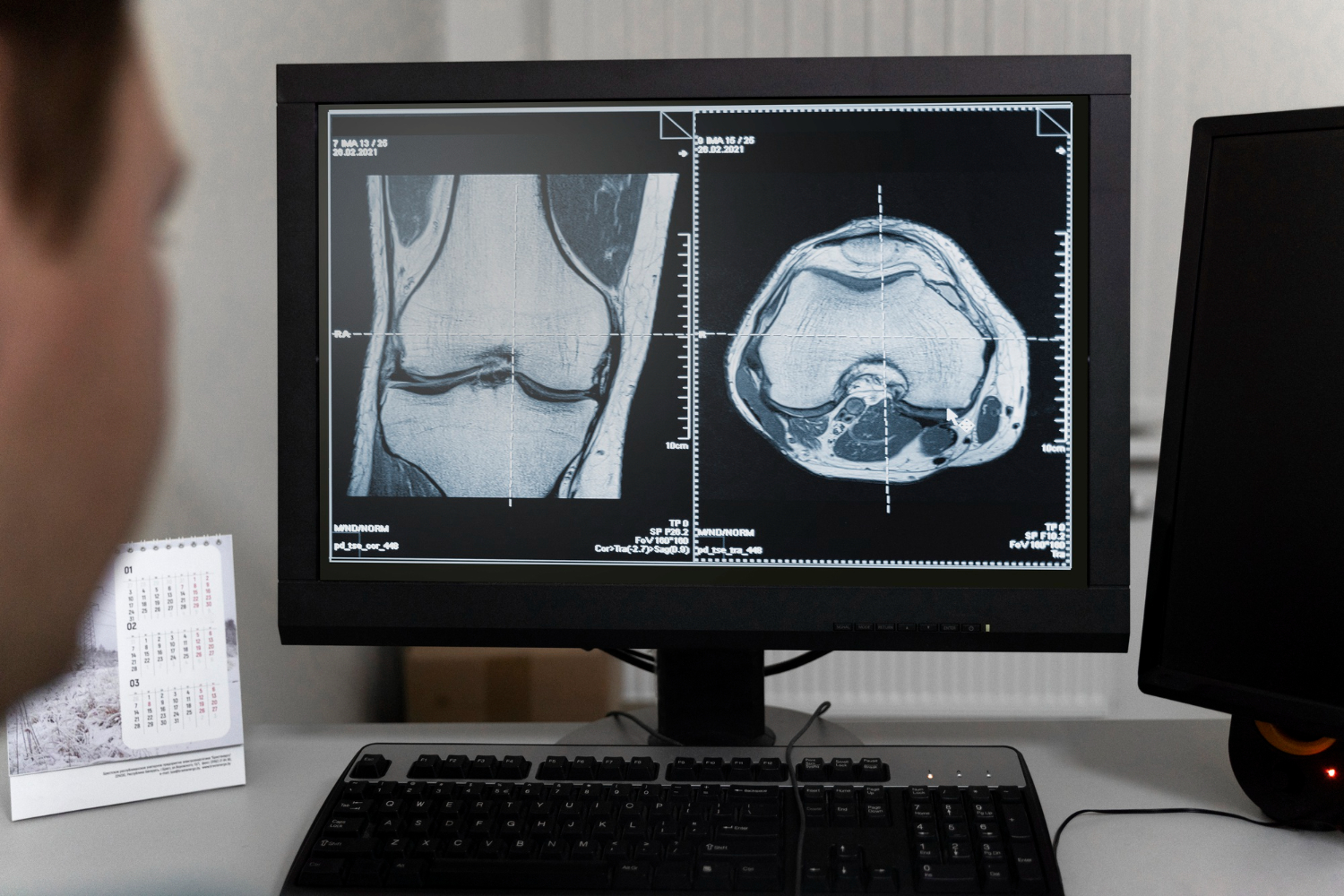 O papel da manutenção na confiabilidade dos exames de imagem em homecare